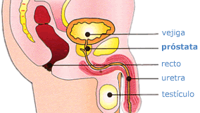 esq_prostata